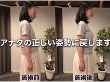 カツ整体院の雰囲気（猫背、巻き肩もカラダの歪みから整えることでシャキッと美姿勢）