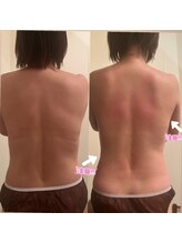 エングロー(Englow)/痩身☆美しいボディラインGET