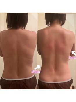 エングロー(Englow)/痩身☆美しいボディラインGET