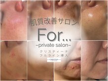 フォー(For...)