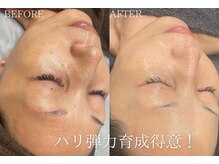 レクシア(LEXIA)の雰囲気（根本的な肌悩み解決。あらゆるトラブルも計画的に肌質改善可能◎）