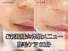 【初回限定☆くすみ改善＆スッキリ美眉】産毛ケア＆眉スタイリング90分¥6,000