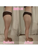 ヨサパーク サーナ 仙川(YOSA PARK Sana)/30代お客様ビフォー⇒アフター