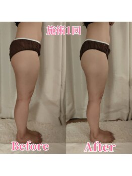 ヨサパーク サーナ 仙川(YOSA PARK Sana)/30代お客様ビフォー⇒アフター