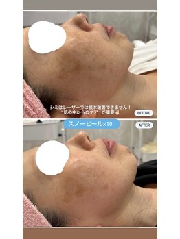 プリマプリート 大垣店/話題のホワイトスノーピール！