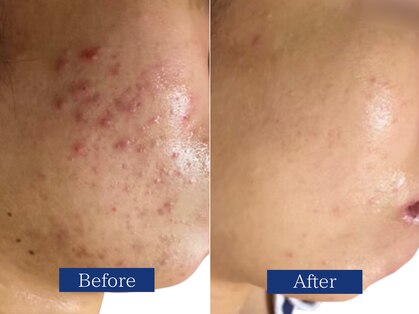 ビズビズ(bisebise)の写真