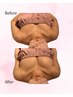 バストアップ人気NO.3【左右差/型/ボリュームUP】二の腕・背中の肉をバストへ