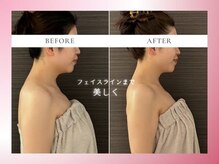 リスブランビューティー(Lys Blanc Beauty)/ドレスに映える背中と小顔へ