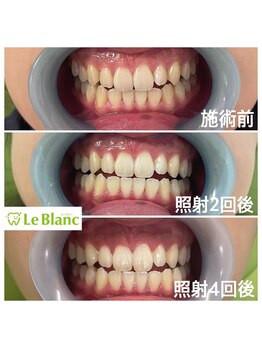 ルブラン 奈良店(Le Blanc)/先日ご来店のお客様!