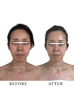 ルルド(Lourdes)/美容は土台から変える