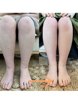 アルモワーズ(armoise)/