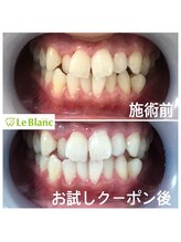 ルブラン 奈良店(Le Blanc)/初めてのでもオススメ！