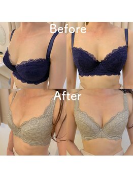 エレナ 伊勢崎(Ele'na)/3ヶ月後ビフォーアフター