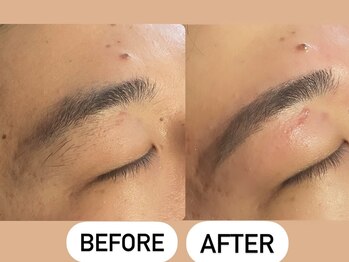 ソーレエルーナ(SOLE e LUNA)/メンズ 新宿 眉毛 ワックス 脱毛