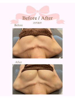 ロココ 安城店(Rococo)/バストアップ症例