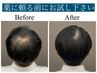 【育毛促進/抜け毛改善】理想の姿に。【100%】ヒト幹細胞ヘッドスパ ¥23100→