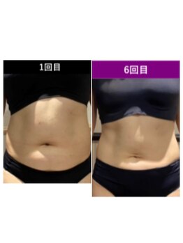 ラウレア(Laule’a)の写真/【最先端技術搭載機器＋強圧ハンド】でダイエットはもちろん体のお悩みを改善☆