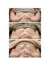 ルアナスタイル(Luana style)/