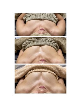 ルアナスタイル(Luana style)/