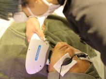 ミシェル(Michelle)/男性のおひげ脱毛の施術風景