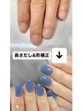 アイネイルズ(Ai nails)/【スカルプ長さだし】＋デザイン