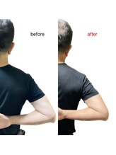 てんでらく/定期的に筋膜リリース