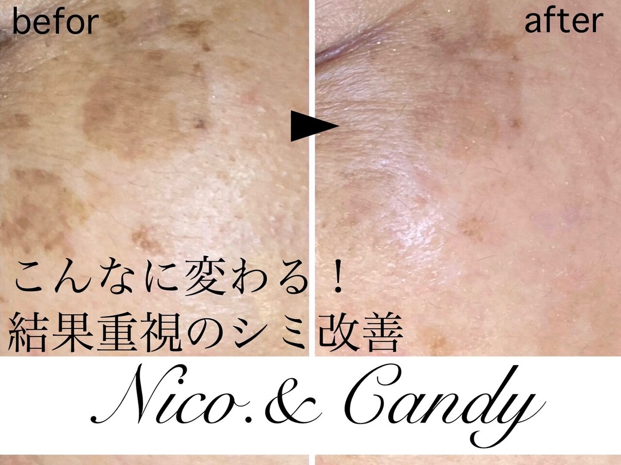 ニコ アンド キャンディー(Nico.&Candy)｜ホットペッパービューティー