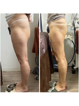 ポラリス(Polaris)/ビフォーアフター