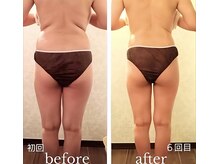 バービーホリック(barbie holic)/１６０分コース 初回/６回目比較