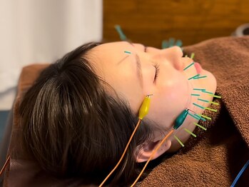 コリとり屋の写真/＼美容鍼モニター価格／プロが肌状況×悩みに合わせて施術!!小顔&リフトアップ効果絶大!初めての方も大歓迎