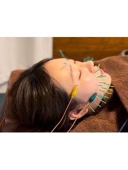 鍼灸施術を受けたい