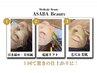 【小顔リフト・美肌・毛穴の最高峰】美容鍼＋美肌マスク＋毛穴レスハーブ★