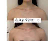 さとう美容整体 町田店/プレ花嫁様♪巻き肩改善定評あり