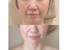 ビオスパ(BioSpa)の雰囲気（小顔になりたい人、むくみ、気になる人必見♪毛穴引き締め効果〇）
