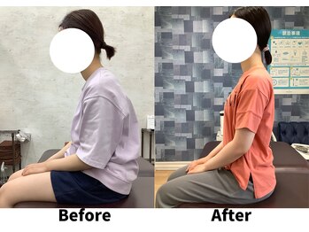 リセラ(Re:seraph)/Before After