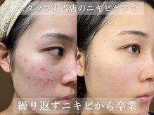 エピア 豊田店(Epia)