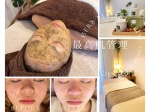 ハーブピーリング 恵比寿の雰囲気（根本改善のハーブピーリングをプライベートサロンで◎）