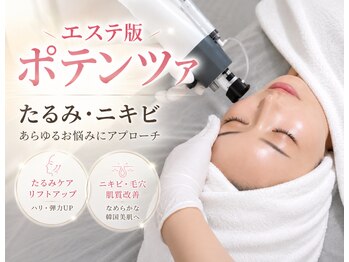 アンノン(Annon)の写真/《リフトアップ×水光肌》エステ版ポテンツァ☆Wヒト幹細胞×エラスチンをダーマ導入＆サーマルRF