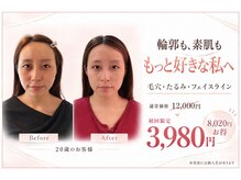 小顔美肌ファクトリー 梅田院