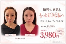 小顔美肌ファクトリー 梅田院