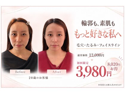 小顔美肌ファクトリー 梅田院の写真