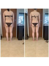 ブランシェ 銀座(blanche)/ブライダルお客様　施術前後