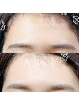 ホワイトアイ 難波(WHITE EYE)/おでこWax♪