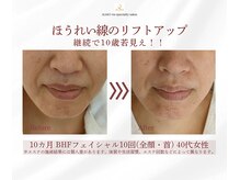 アルモ(ALMO)/若見え！どんどん増加中