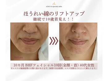 アルモ(ALMO)/若見え！どんどん増加中