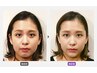 【リフトアップ】重たい頭皮から解放！すっきり小顔ヘッドスパ80分23,000→