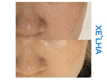 シューラディアント(ShuRadiant)/韓国セラピール