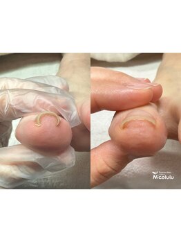 爪の悩みを解消できる（ケア含む）