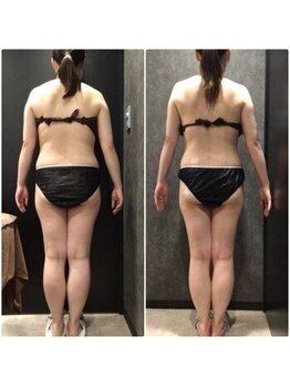 フローボディ 新山口店(flow BODY)/山口のエステはflow BODY