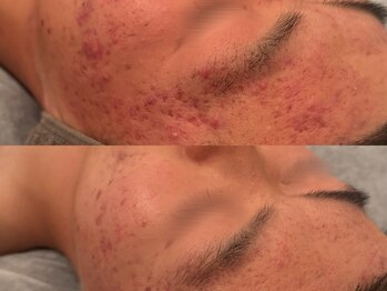 ポーデベロア(Peau des velours)/陶肌トリートメント/ホームケア